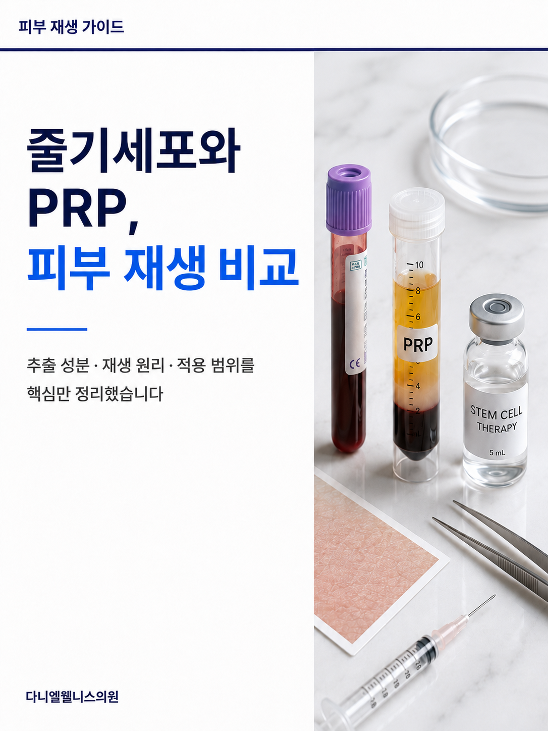 줄기세포와 PRP, 피부 재생 비교