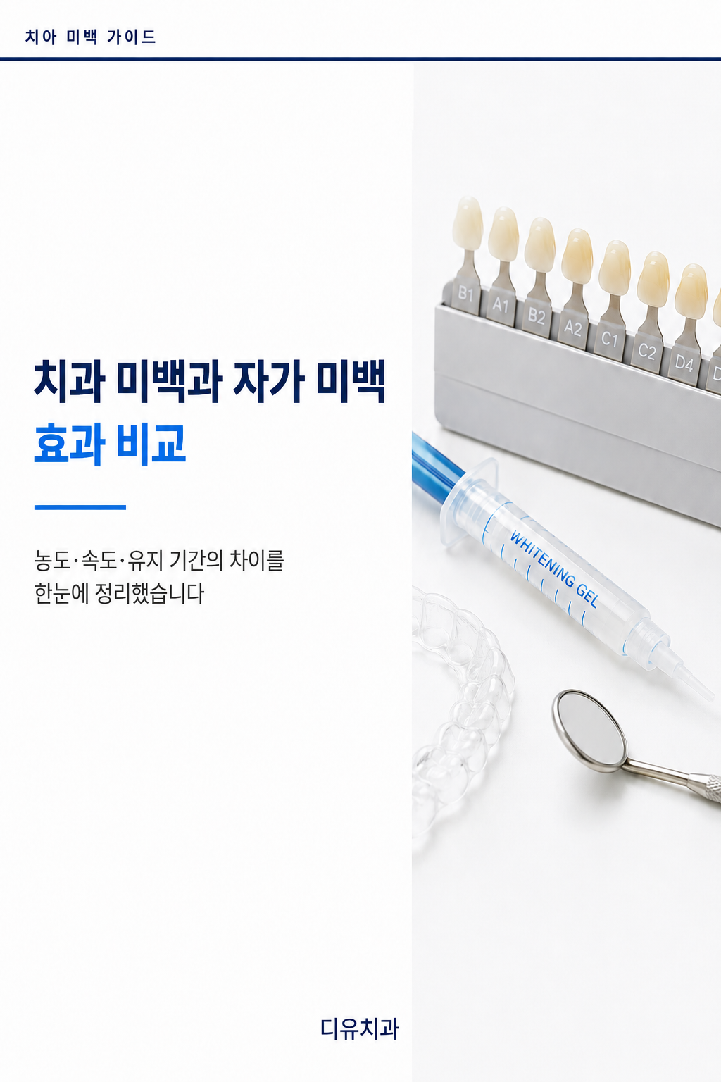 치과 미백과 자가 미백 효과 비교
