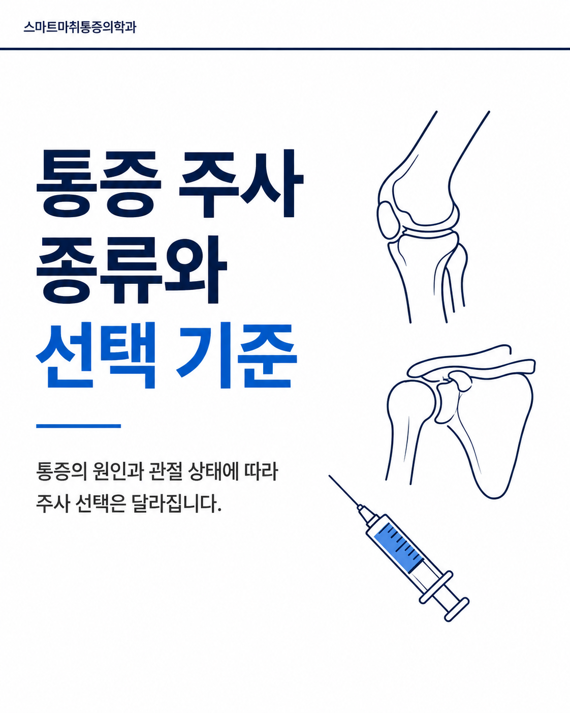통증 주사 종류와 선택 기준