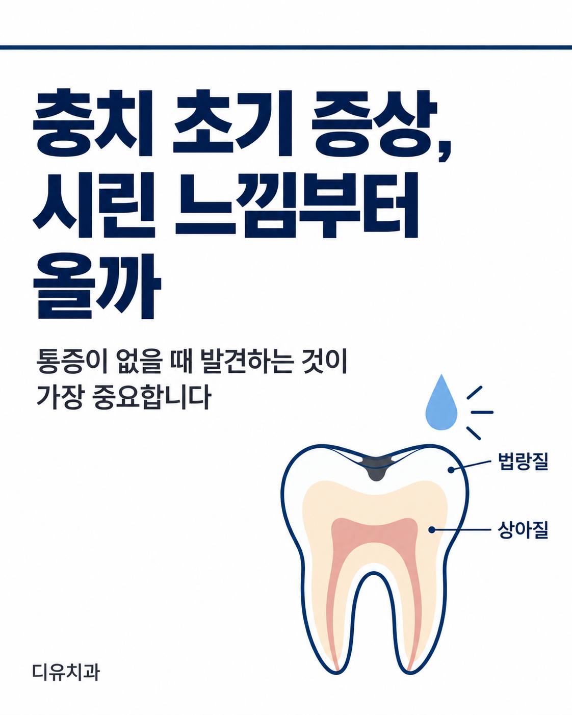 충치 초기 증상, 시린 느낌부터 올까