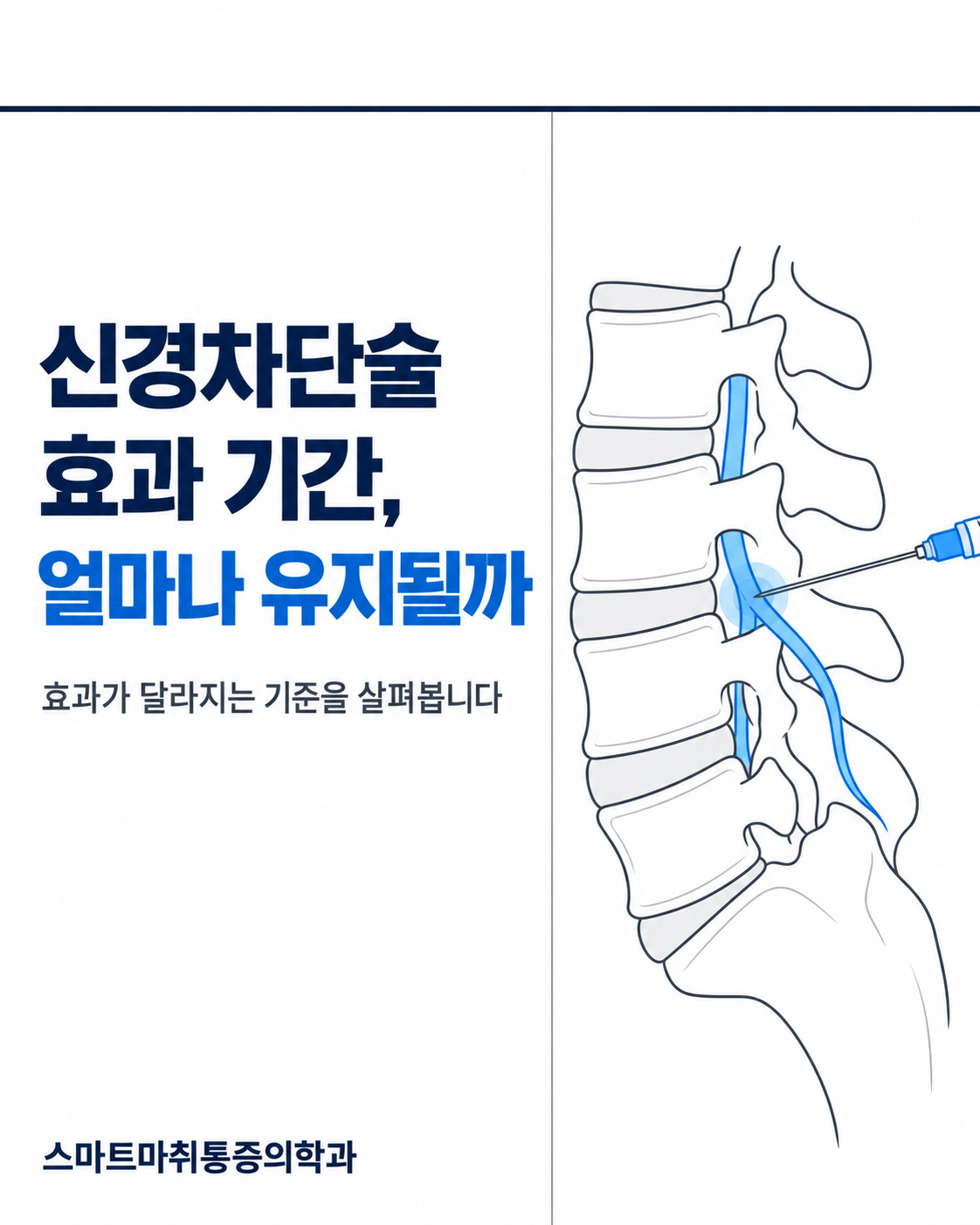 신경차단술 효과 기간, 얼마나 유지될까