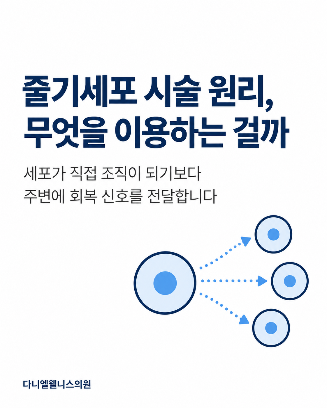 줄기세포 시술 원리, 무엇을 이용하는 걸까