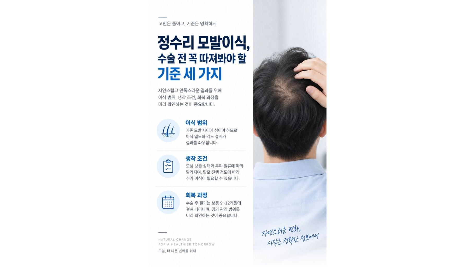 정수리 모발이식, 수술 전 꼭 따져봐야 할 기준 세 가지